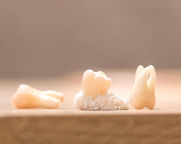 Knochenaufbauende Maßnahmen